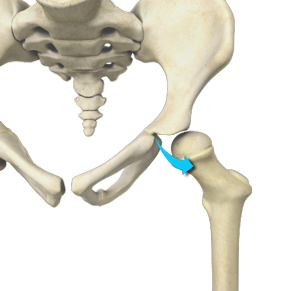 Developmental Dysplasia